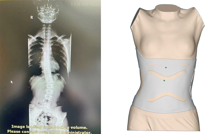 1597997153589006.jpg 3d spine and IReal 2S health care.jpg